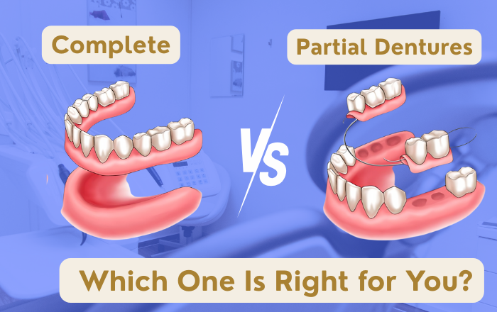 Complete vs. Partial Dentures: Which One Is Right for You?