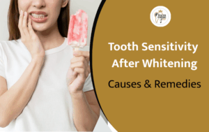 Managing Tooth Sensitivity After Whitening: Causes and Remedies