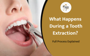 What Happens During a Tooth Extraction? Full Process Explained