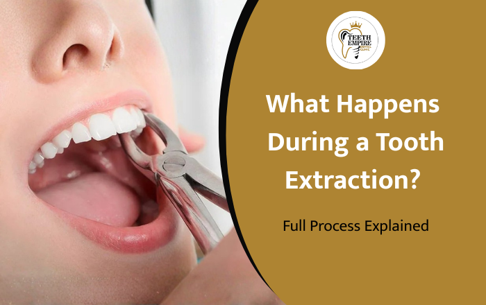 What Happens During a Tooth Extraction? Full Process Explained